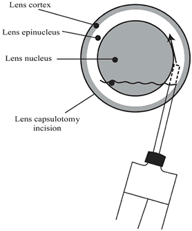 Lens Cortex