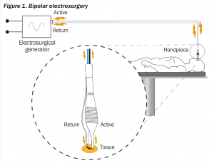 Electrosurgery & Electrocautery: What's The Difference? - Cairn