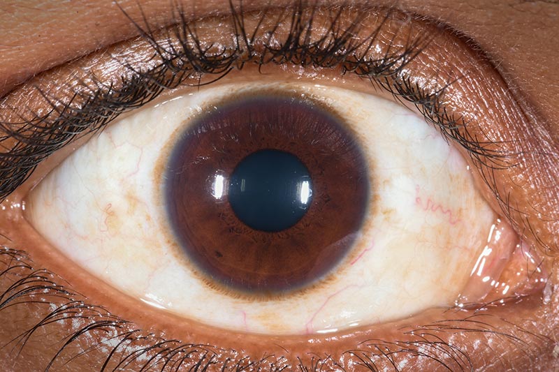 Close up image of a healthy eye
