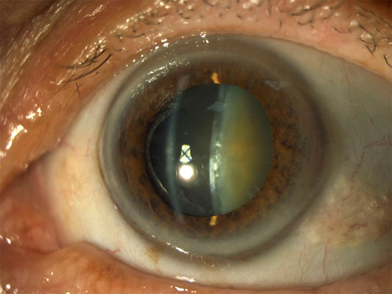 Close up image of an eye