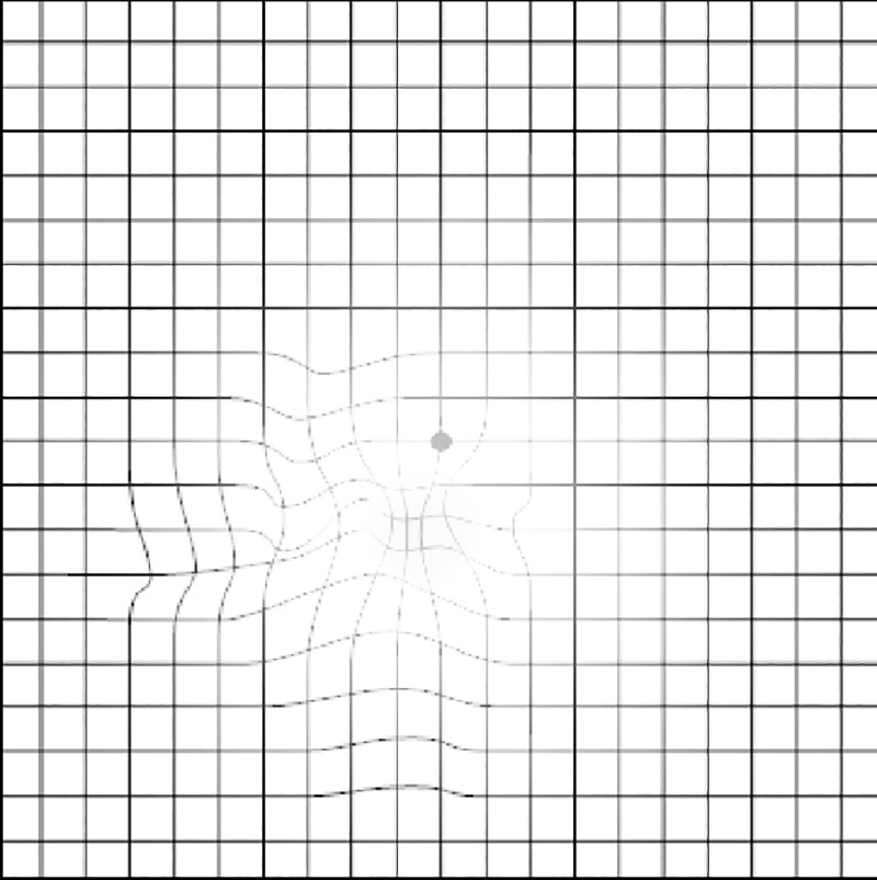 The Amsler Grid within the visual field; drawing photocopied with