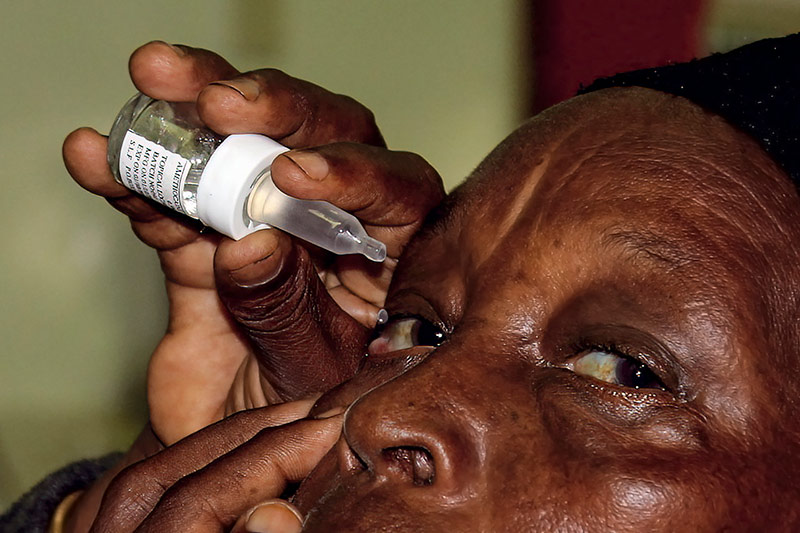 A lady pulls down her lower eyelid with her left hand and squeezes eye drops from a bottle into her right eye using her right hand