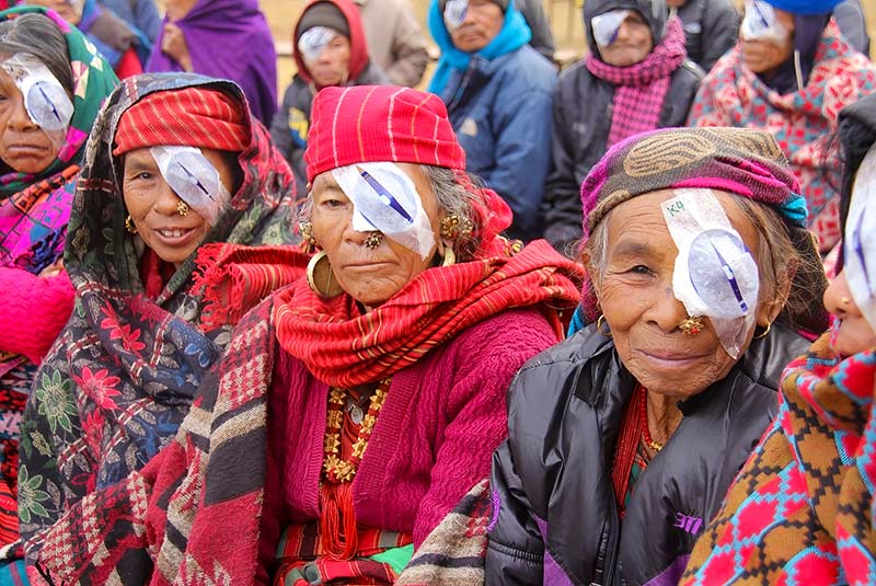 A group of women sittign together. All are wearing eye patches over on e eye.