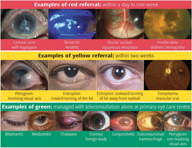 A series of images of eyes from patients with different eye conditions
