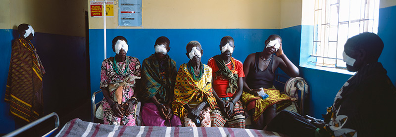 Six post-operative cataract patients, five sitting down and 1 standing, all with eye patches