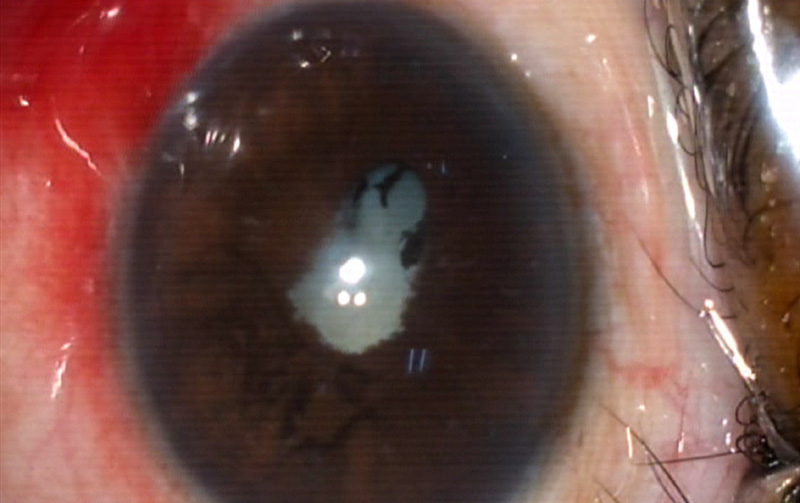 Close up image of the eye