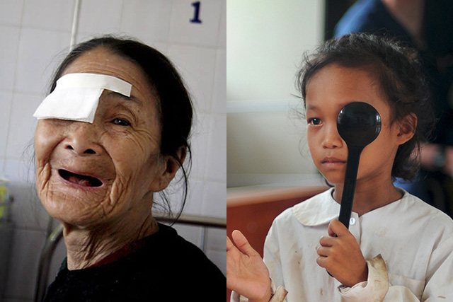 Older woman and young girl receiving eye care services