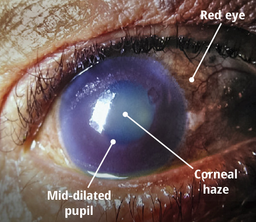 Close up of the eye with labelling